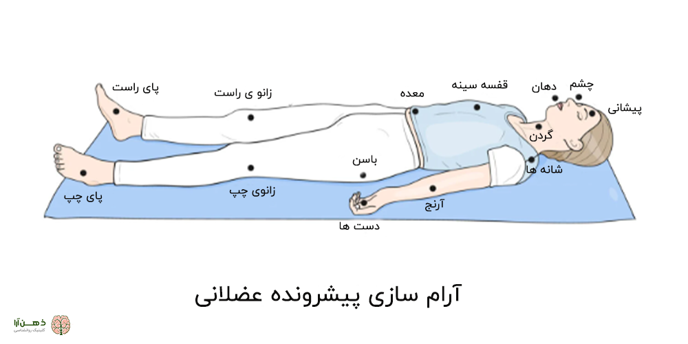 تکنیک آرام سازی پیشرونده عضلانی